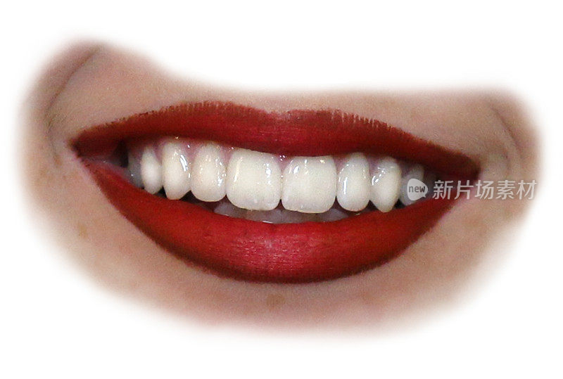 快乐少女的嘴巴微笑，嘴唇，舌头和完美的牙齿咬合/微笑后，由正牙医生的牙医，白色的牙齿和牙齿微笑，嘴唇，牙齿与红色唇膏，切割出孤立的嘴巴白色背景